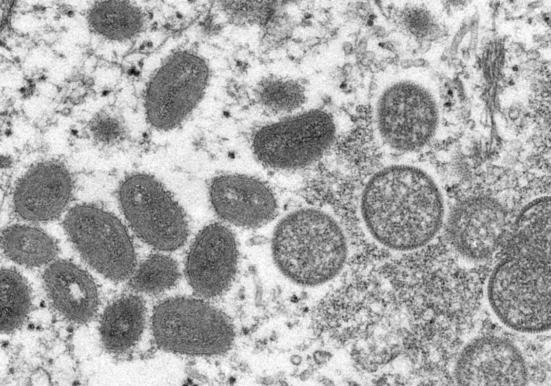 Monkeypox virus
